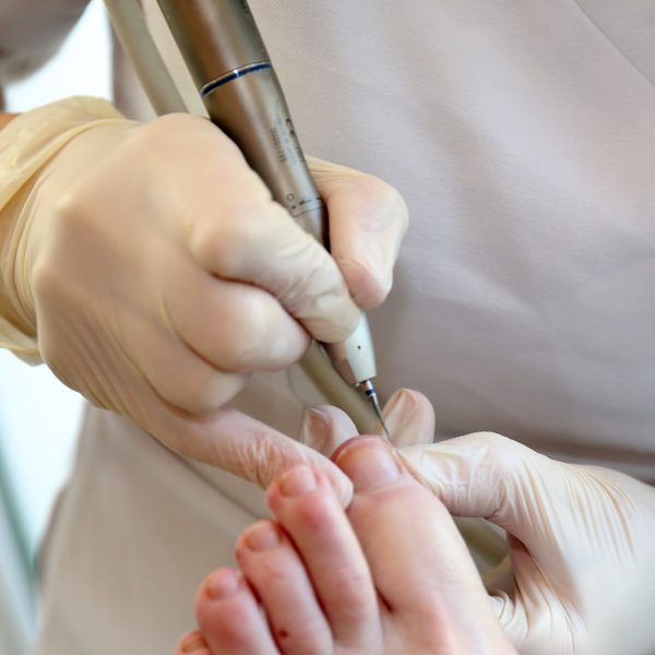 Medische pedicure Voet in 't nieuw 8
